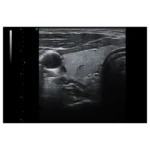 USM cihazı HD42Plus