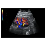 USM cihazı HD42Plus