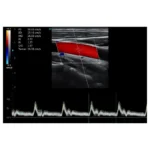 USM cihazı HD42Plus