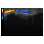 USM cihazı HD42Plus